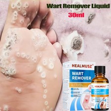 Skin Tag Remover and Repair Liquid Mole Corrector Wart Skintag Foot Corn removal