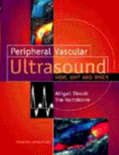 Peripheral Vascular Ultrasound: How, Why and When, Hartshorne HND in Biology, Ti