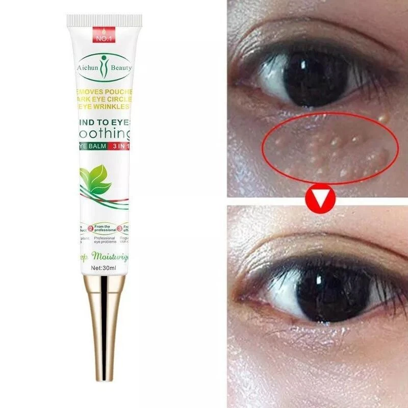 Aggregate more than 137 vitamin e for eye bags best esthdonghoadian