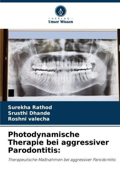 Photodynamische Therapie Bei Aggressiver Parodontitis: Surekha Rathod-image