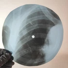 BEATLES BLACKBIRD X-Ray USSR Record Roentgen Bone Ribs Music Vinyl
