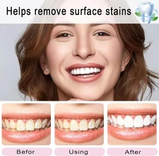 Niacinamide Intensive Whitening Toothpaste Fresh Breath Teeth Cleaning 100gm