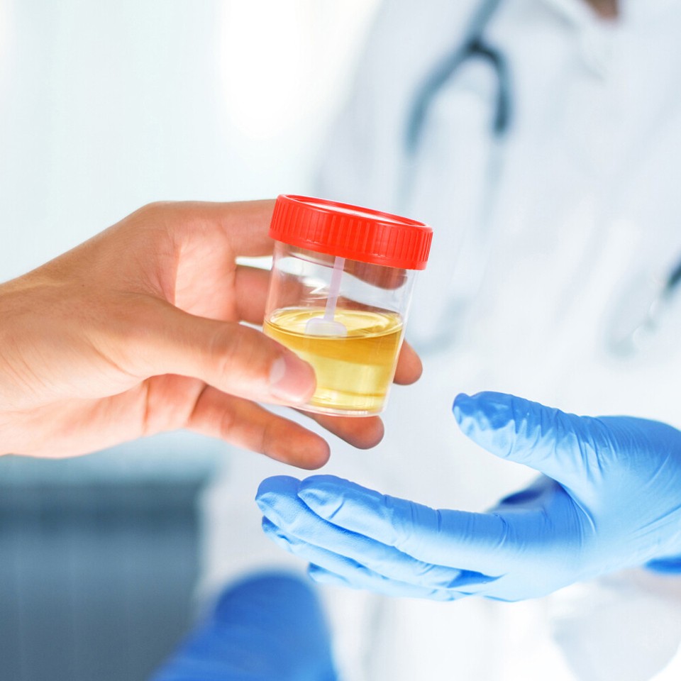 3 Pieces Urine Cups Sputum Pots with Lids Beaker Sample The eBay