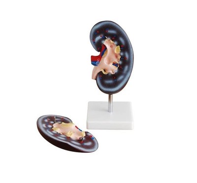 Human Kidney Model 2 Parts Anatomical Medical Teaching for Students Lab