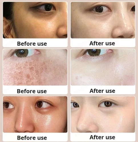 Juelreou Purifying Cleanser, Xuerouyar Cleanser, Juelreou Cleansing Milk - Picture 5 of 10