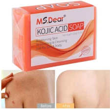 Kojic Acid Soap Skin Brightening Soap Dark Spot Remover Soap 100g Skin Whitening