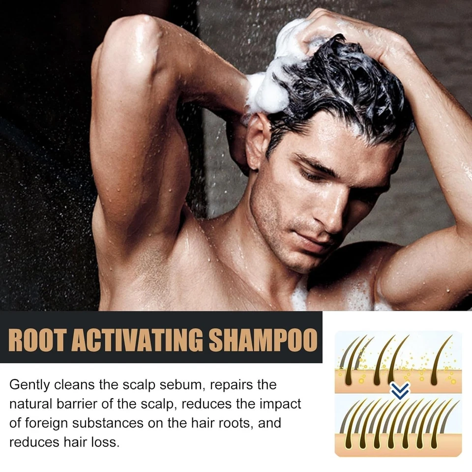 Champú activador de raíz espartana, champú contra la caída del cabello, promueve el crecimiento del cabello - 2 piezas - Imagen 3 de 4