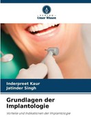 Inderpreet Kaur (U. A.) | Grundlagen Der Implantologie | Taschenbuch | Deutsch