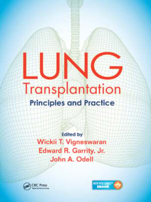 Lung Transplantation: Principles and Practice by Wickii Vigneswaran: New