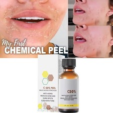 Facial Peel Chemical Serum Malic Citric Acid Exfoliating Brightening Essence AU