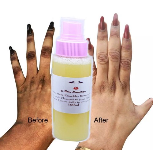 Dark Knuckle Cream /Exfoliating Scrub / Knuckle Cleanser /Triple Pack Set - Picture 4 of 4