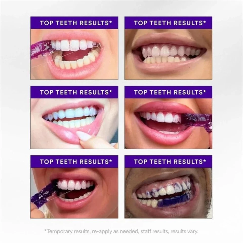 Hismile V34 Whitening Strips, Teeth Whiten Strips, Purple Tooth Whitening - image 3 of 4