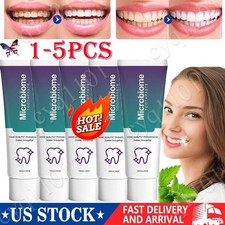 1-5PCS Microbiome Mint Flavor Gum Toothpaste Cleaning Toothpaste Sensitive Teeth