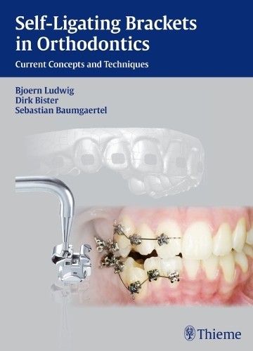 Self-ligating Brackets in Orthodontics by Bjrn Ludwig, Dirk ... - 9783131547019