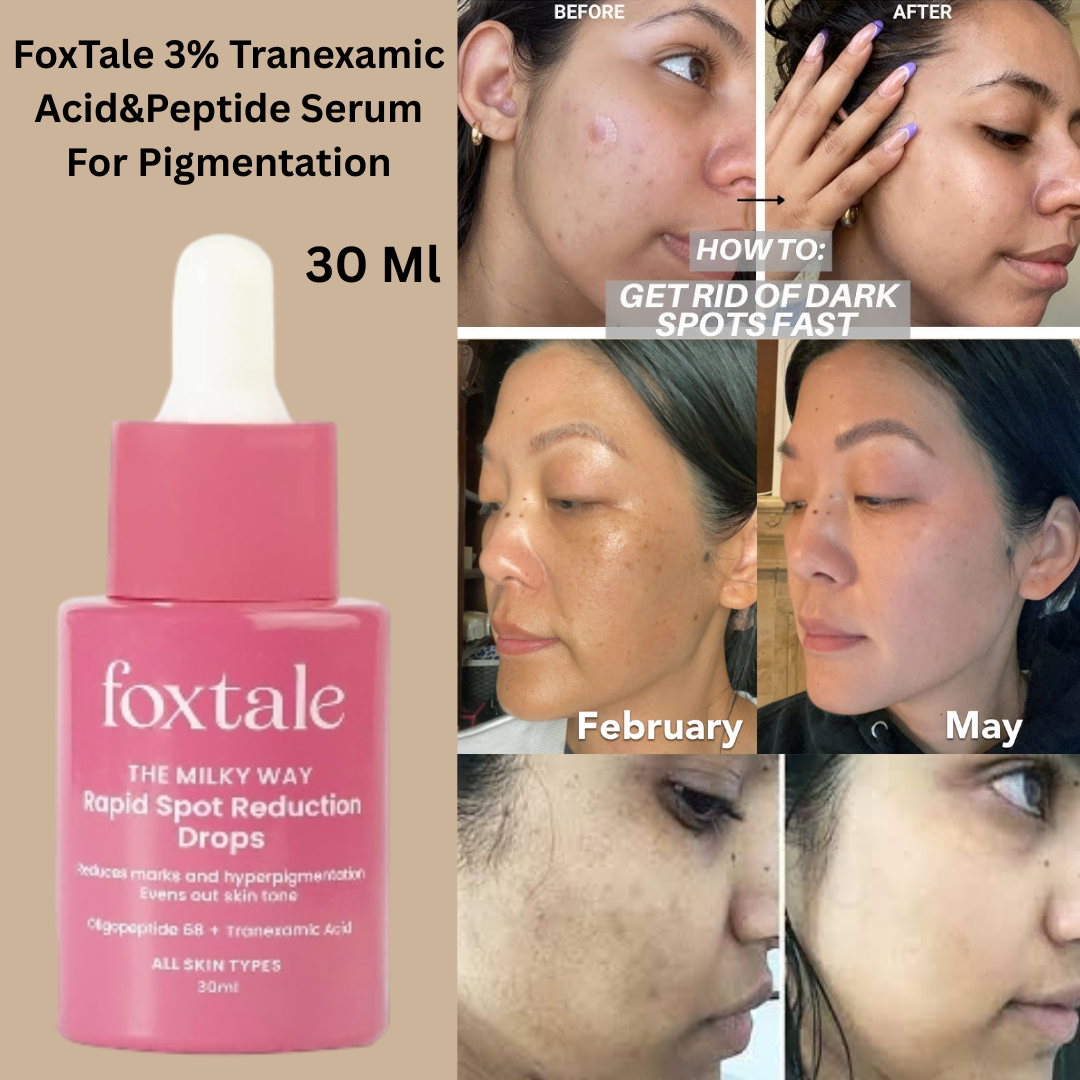 Foxtale 3% Tranexamic Acid Peptide Serum for Hyperpigmentation 30ml