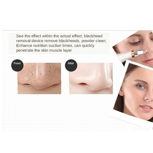 skin suction cleaner