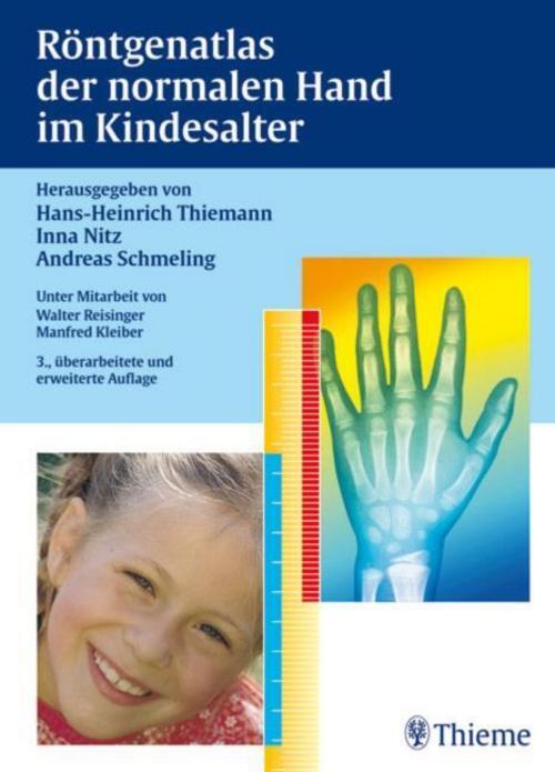 Röntgenatlas Der Normalen Hand Kindesalter Hans-heinrich Thiemann