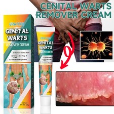 Genital Wart Removal Cream 20g Skin Treatment Wart Remover Fast Acting FormulaUS