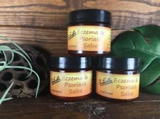 Get Relief from Eczema & Psoriasis with this Healing Salve Natural & Organic