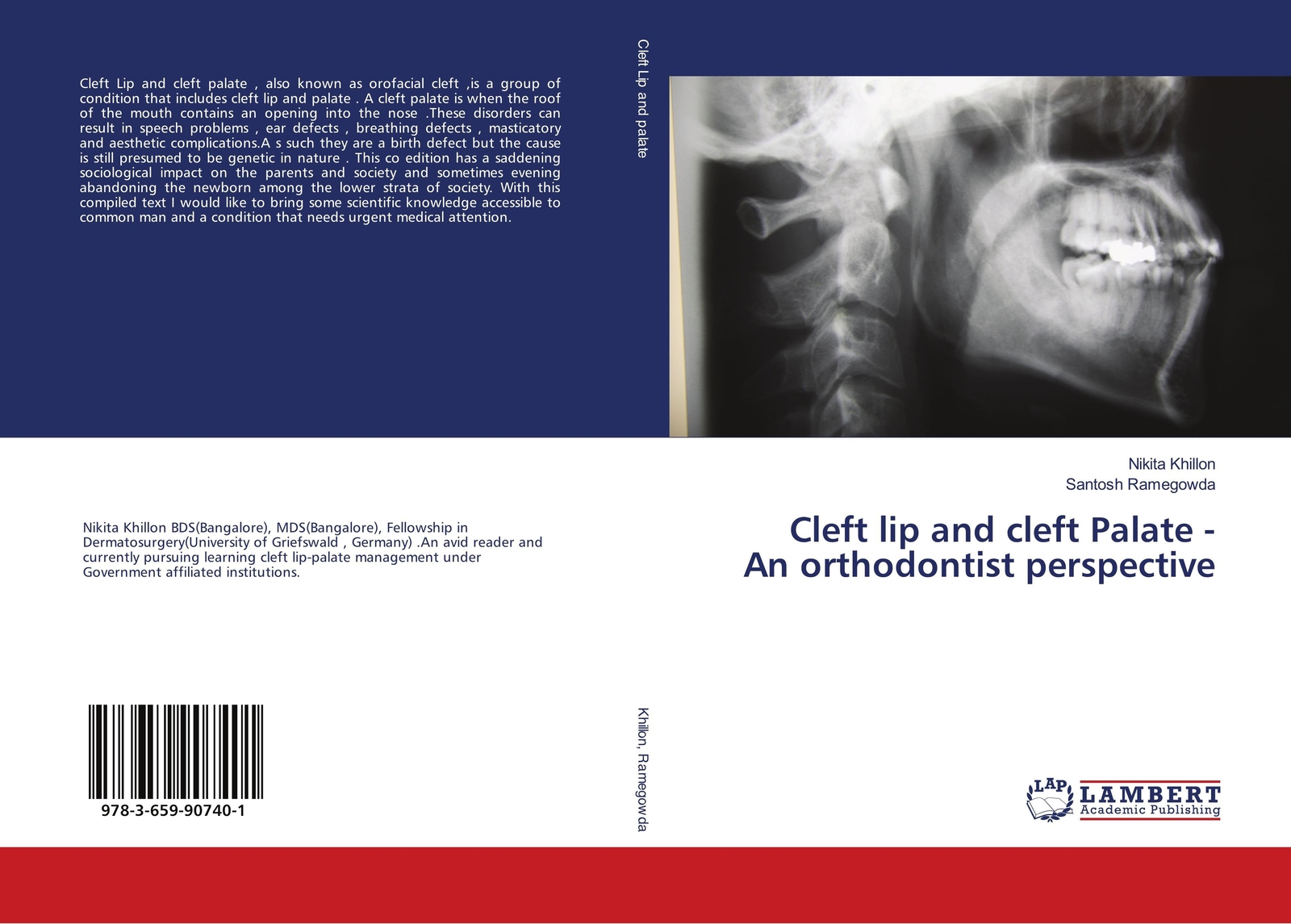 Thumbnail - Nikita Khillon (u. A.) | Cleft Lip And Cleft Palate - An