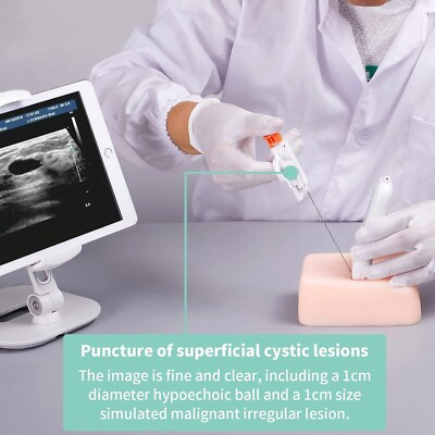 Ultrasound Guided Superficial Nodule Puncture Models Lymph Biopsy Puncture Train