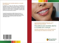 PrevalêNcia De Mordida Aberta E Cruzada Em CriançAs Alessandra De Albuquerque Ta