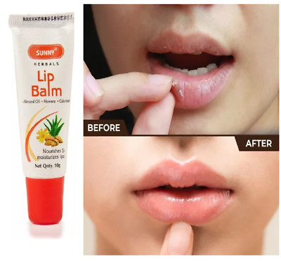 Bakson Sunny Lip Balm (10g) Moisturizes & Nourishes Lips Heals chapped lips