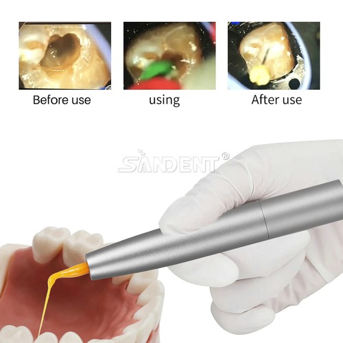 Manipolo scalatore aria dentale attivazione irrigazione periodo&3 punte adatto KaVo/30 punte - Foto 10 di 47