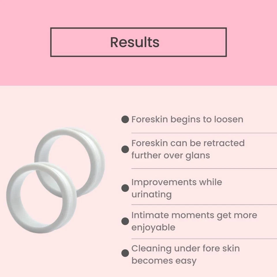 Vajraang Phimosis Stretching Rings (20 Rings Set) With Applicator Tool - image 4 of 4