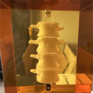 Human Spine Vertebrae Anatomical Model Amber Resin Block