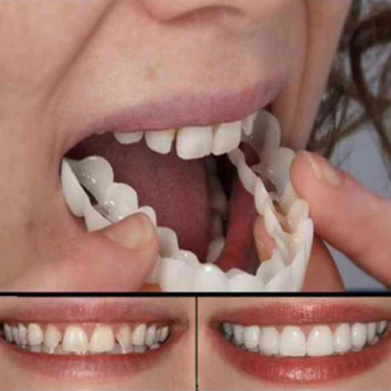 Odontología cosmética prótesis dentadura postiza para dientes falsos ocultar huecos