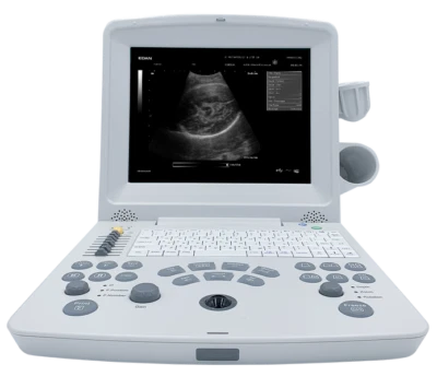 Edan DUS60 Portable Ultrasound