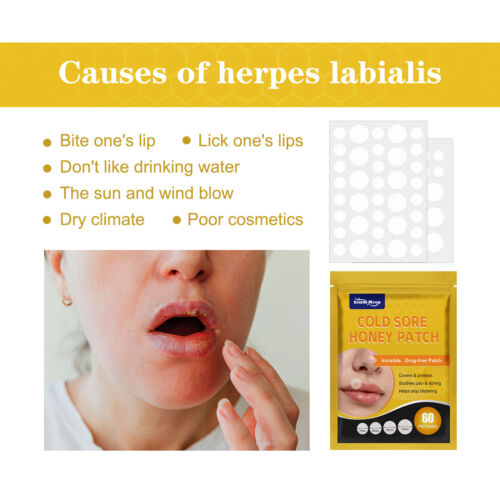 60Pcs Cold Sore Healing Patches Fast Heals Cold Sores Blister Lip Skin Treatment - Picture 6 of 11