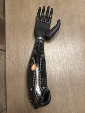 Aether Biomedical Zeus V1 bionic hand w/carbon fiber prosthetic arm