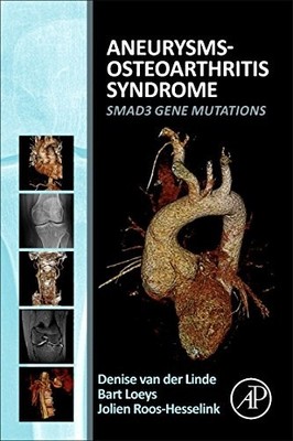 Aneurysms-Osteoarthritis Syndrome: ..., van der Linde, 