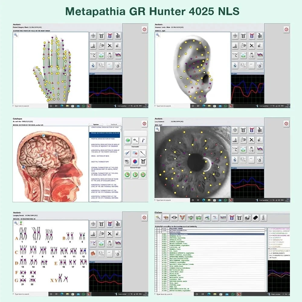 New Metatron Hunter 4025 NLS VERIFIED Bioresonance Therapy - 2025