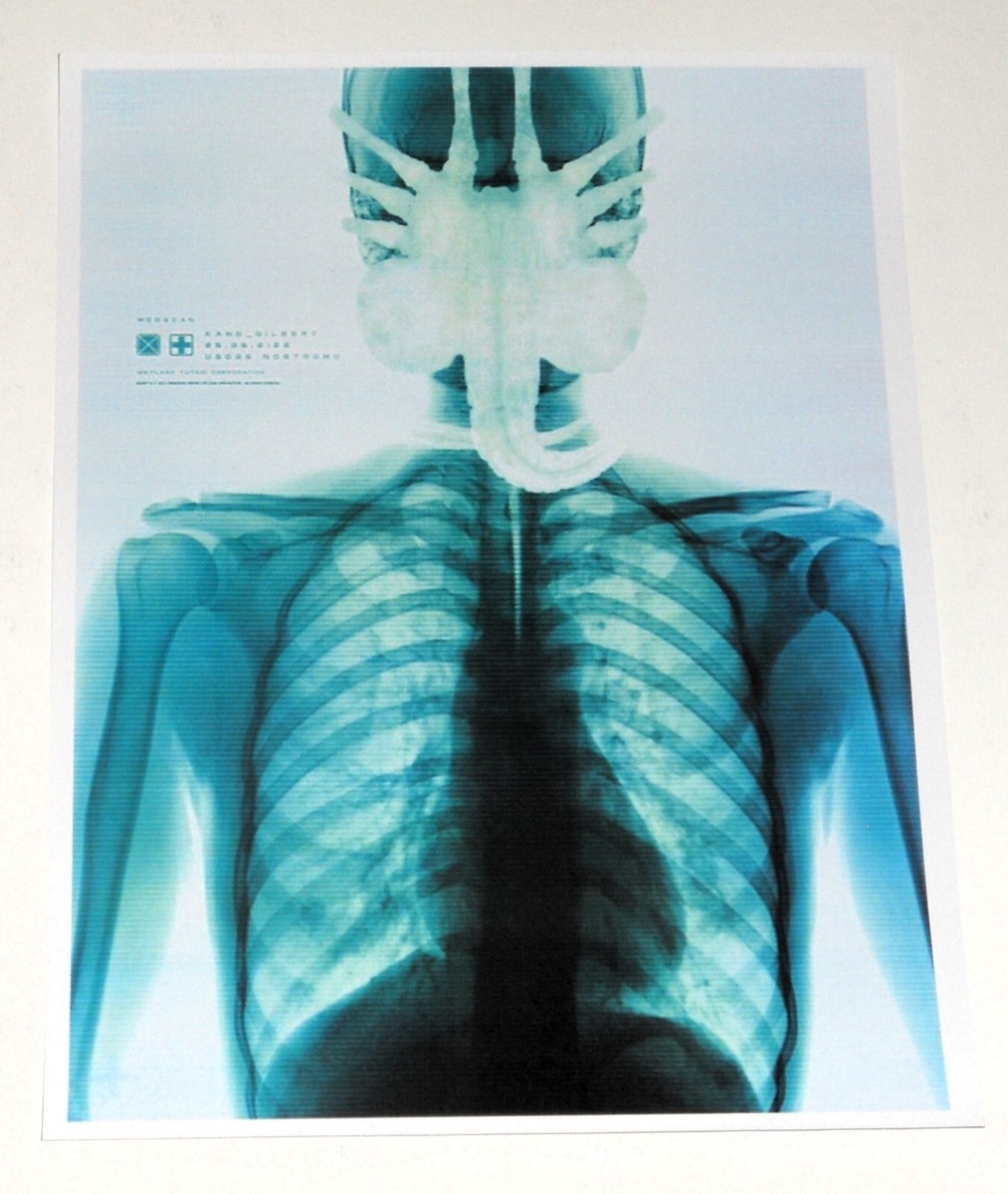 Alien 1979 KANE X-RAY Facehugger unreleased Poster 9