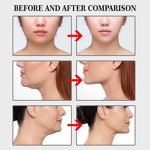 100PC Set Instant Face Neck and Eye Lift Facelift V Shape Tapes Anti- Wrinkle - Picture 5 of 7