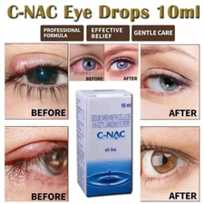 C-NAC Eye Drops Cure Cataract Carnosine NAC Glaucoma Bright Clarity