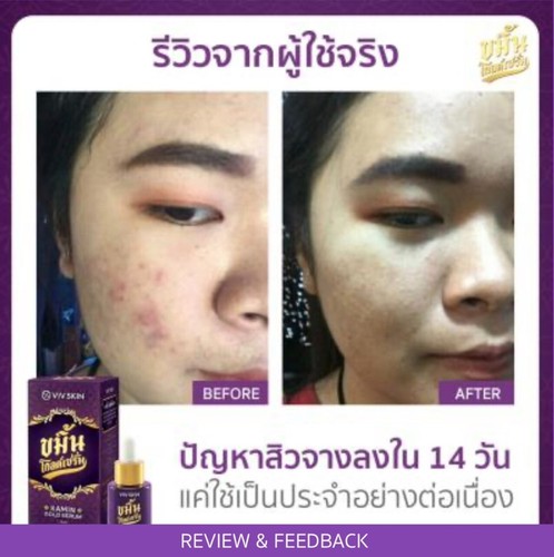 Turmeric Gold Serum Reduce Acne Dark Spot Wrinkles face 14 ml - Picture 21 of 23