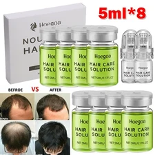 8Pcs Advanced Hair Regrowth System, Hair Growth Treatment Ginseng Solution Set