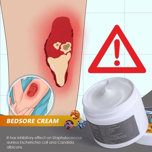 50g Sumifun Decubitus Cream Bedsore Plaster *1 - Bild 5 von 10