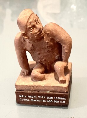 Vintage Schering Pharmaceutical Mayan Valisone Advertising Figure Skin Lesions