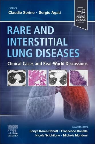 Rare and Interstitial Lung Diseases by Claudio Sorino, Sergio... - 9780323935227
