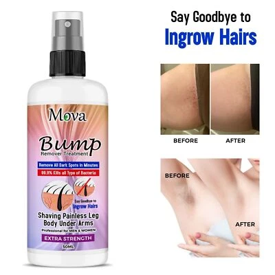 MOVA MEN/WOMEN Ingrown Hair Bump Remover Shaving Painless Leg,Body,UnderArms 50ML UK
