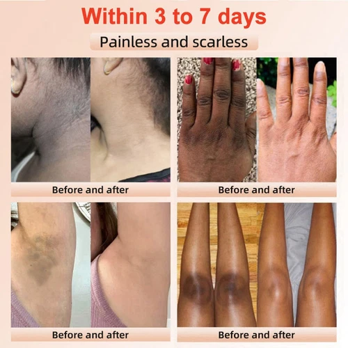 3X Purifying Exfoliating Gel, Quarxery Cleansing Purifying Cream for Face & Body - Bild 6 von 15