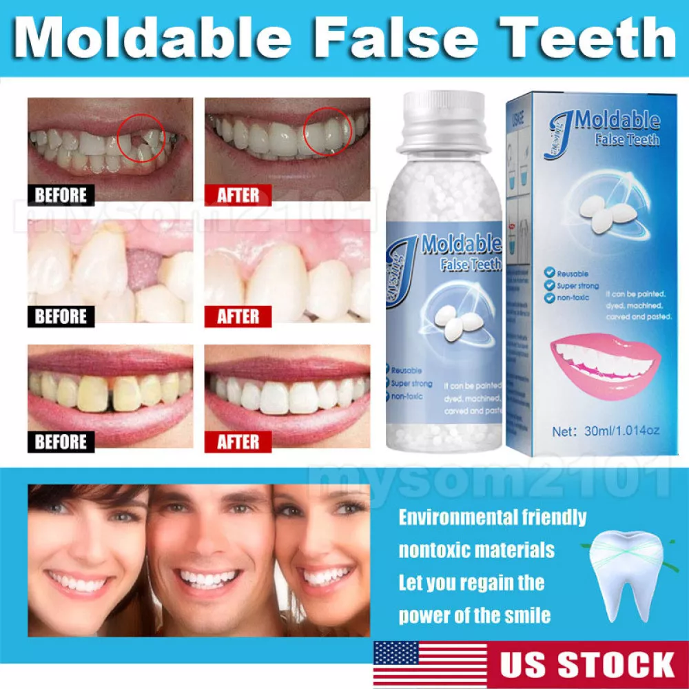 Tooth Repair Granules, Temporary Moldable Dental Pellets, Moldable False  Teeth