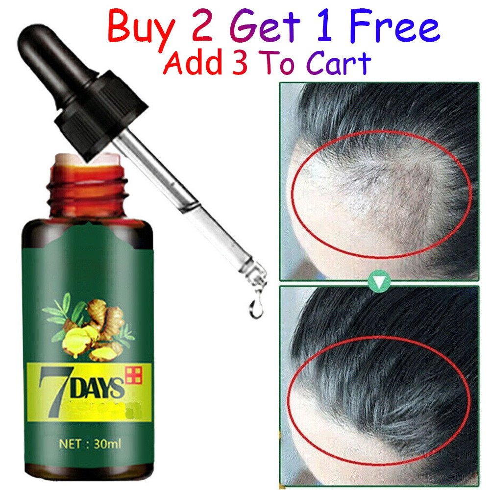 Regrow 7 Day Ginger Germinal Hair Growth Serum Hairdressing Oil Loss Treatment eBay