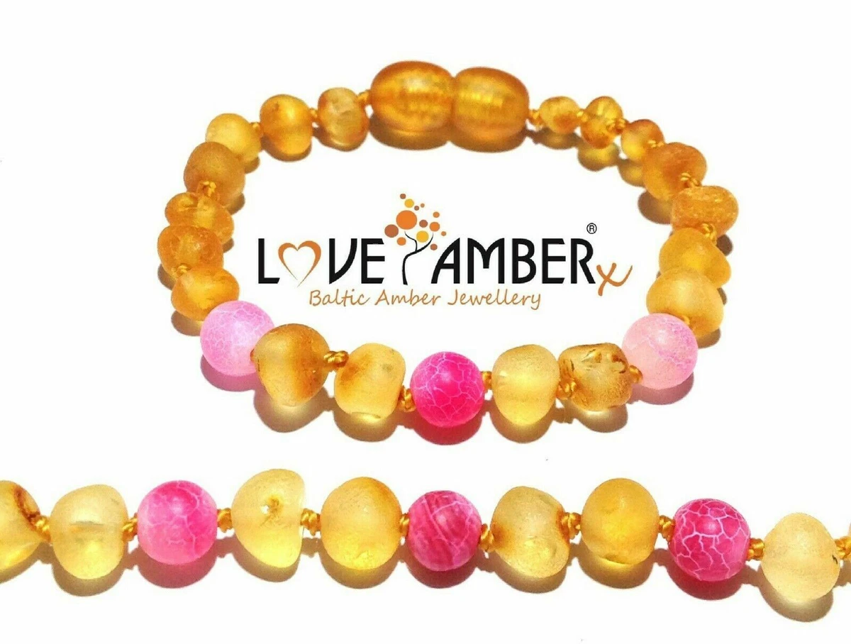 Love amber sale bracelet