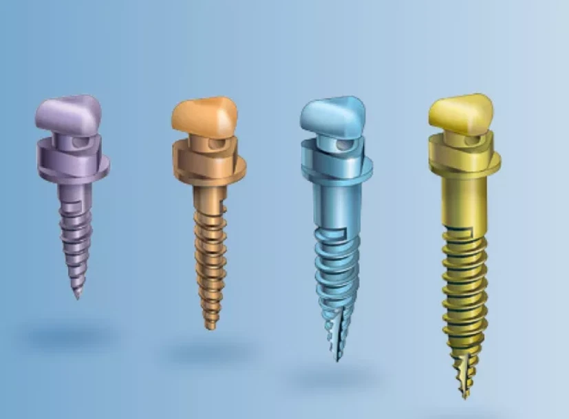 Ormco VectorTAS 12MM/10MM/8MM/6MM MINI-TORNILLO-PK6 Foto 2 de 2